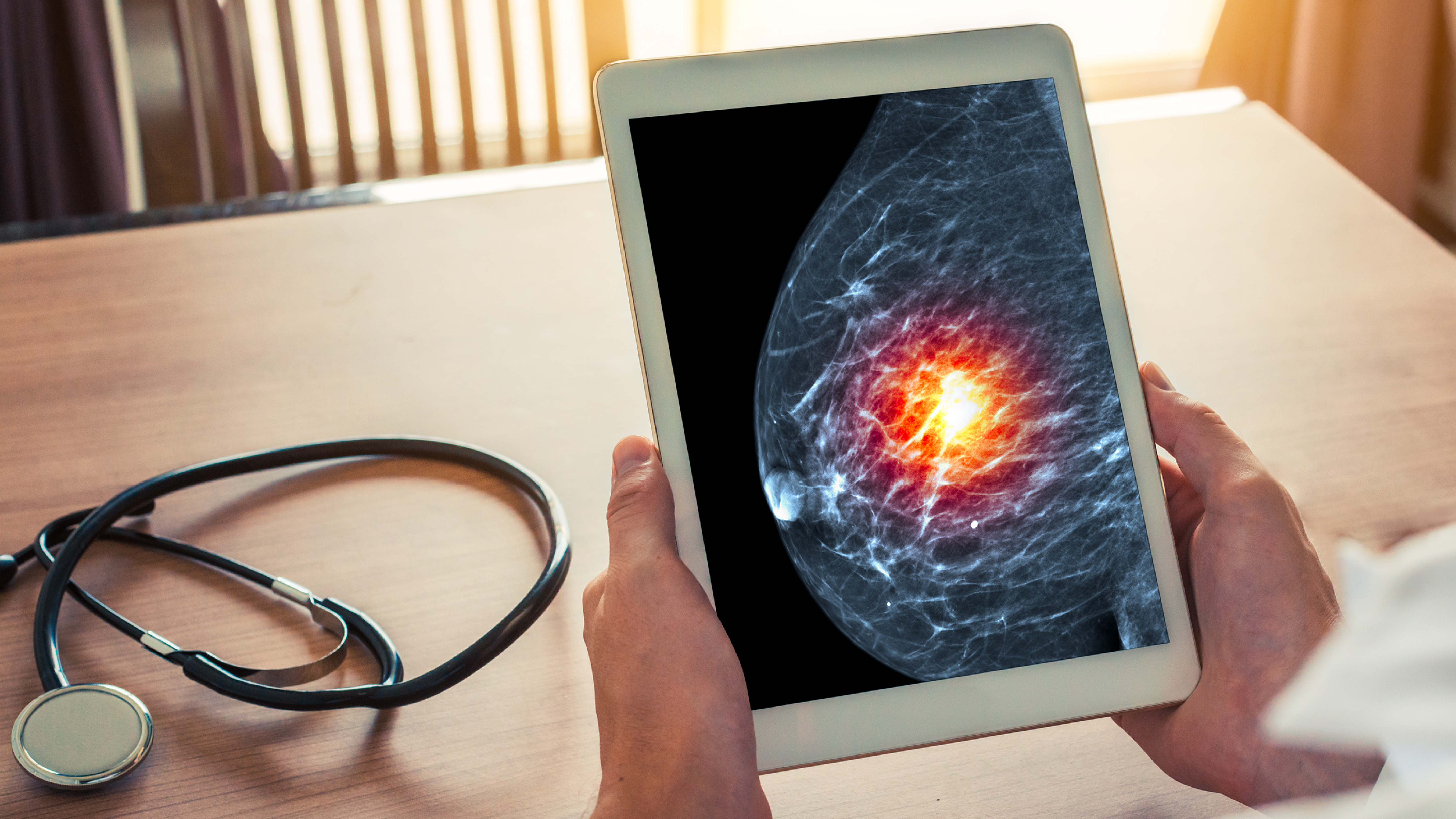 健康・医学 Breast Cancer New Guidelines Move Beyond Chemotherapy for Patients With